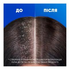 Шампунь Head & Shoulders Для чувствительной кожи 400 мл Фото 4