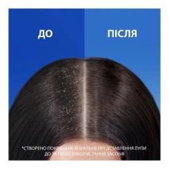 Шампунь Head & Shoulders Против перхоти Яблочная свежесть 800 мл Фото 2